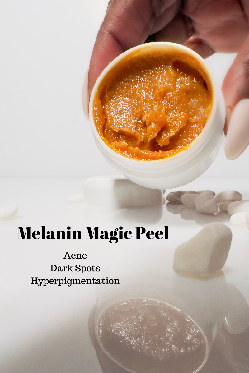 Melanin Magic Peel ( for Hyperpigmentation & Acne)